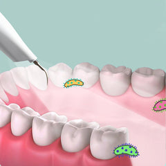 Ultrasonic Teeth Cleaner