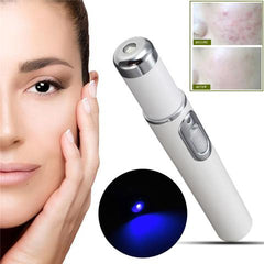 Blue Light Facial Treatment Device